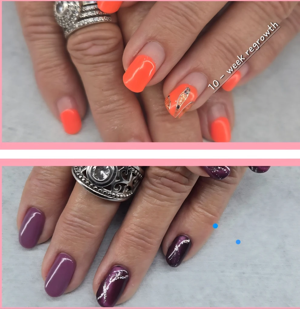 Intricate black and white floral pattern on a single nail